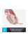 Навушники Logitech Zone Vibe 100 Wireless Rose (981-001224)